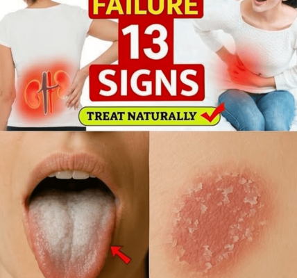 13 Early Signs of Kidney Failure (You Ignore Daily) | Symptoms of Kidney Failure 13 Early Signs of Kidney Failure (You Ignore Daily) | Symptoms of Kidney Failure