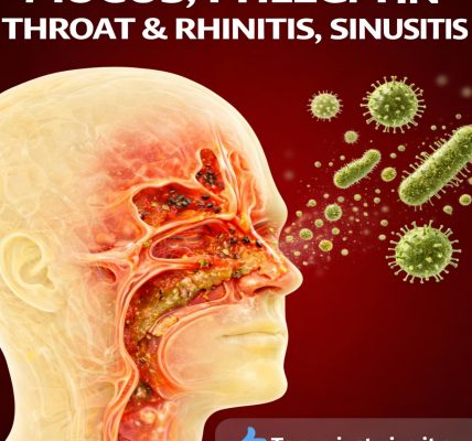 Eliminate Mucus, Phlegm in the Throat and Nose, and Rhinitis Naturally: Powerful Home Remedies