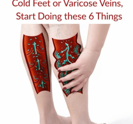 If You Have Poor Circulation, Cold Feet or Varicose Veins, Start Doing These 6 Things