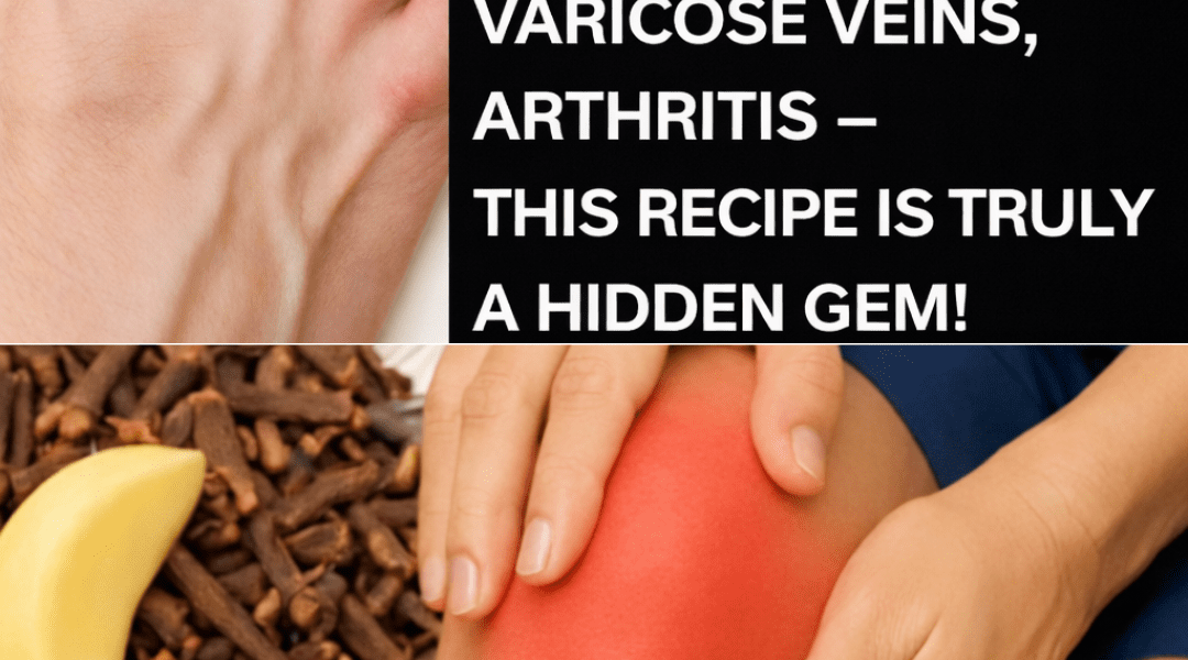 Natural Relief for Muscle Pain, Joint Inflammation, and Poor Circulation Using Garlic, Cloves, and Ginger