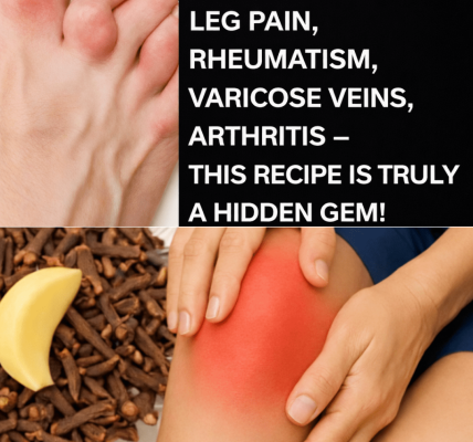 Natural Relief for Muscle Pain, Joint Inflammation, and Poor Circulation Using Garlic, Cloves, and Ginger