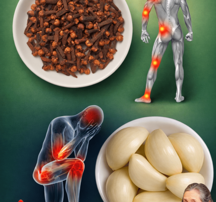 Garlic & Clove Oil: The Natural Remedy People Are Using to Reduce Varicose Veins and Boost Circulation Garlic & Clove Oil: The Natural Remedy People Are Using to Reduce Varicose Veins and Boost Circulation