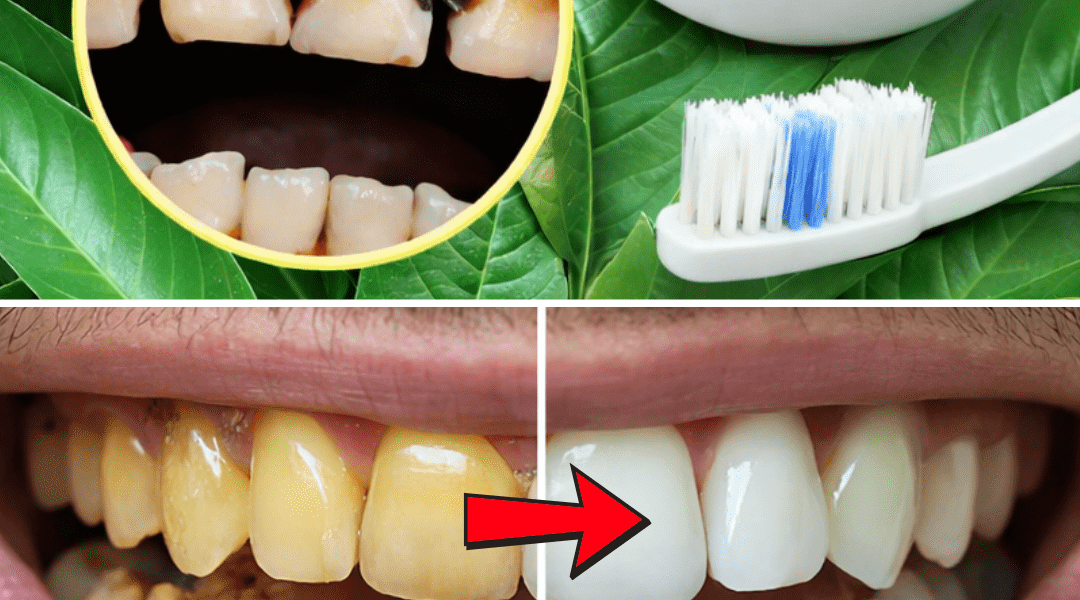 Top 3 Ways to Treat Tooth Decay with Guava Leaves – Simple and Cost-Effective