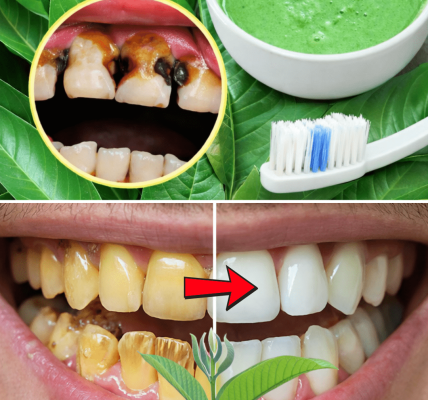 Top 3 Ways to Treat Tooth Decay with Guava Leaves – Simple and Cost-Effective