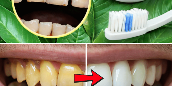 Top 3 Ways to Treat Tooth Decay with Guava Leaves – Simple and Cost-Effective