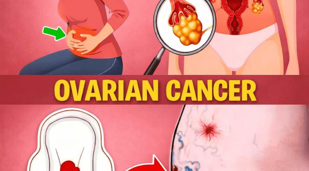 8 Common Signs of Ovarian Cancer Every Woman Should Recognize Early
