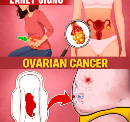 8 Common Signs of Ovarian Cancer Every Woman Should Recognize Early