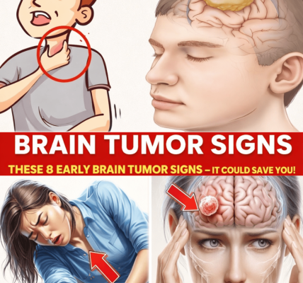Don’t Miss These 8 Early Signs of a Brain Tumor – Early Detection Can Make a Difference Don’t Miss These 8 Early Signs of a Brain Tumor – Early Detection Can Make a Difference