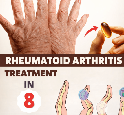 Rheumatoid Arthritis: Latest Treatment Advances and Hope for Better Days Ahead Rheumatoid Arthritis: Latest Treatment Advances and Hope for Better Days Ahead