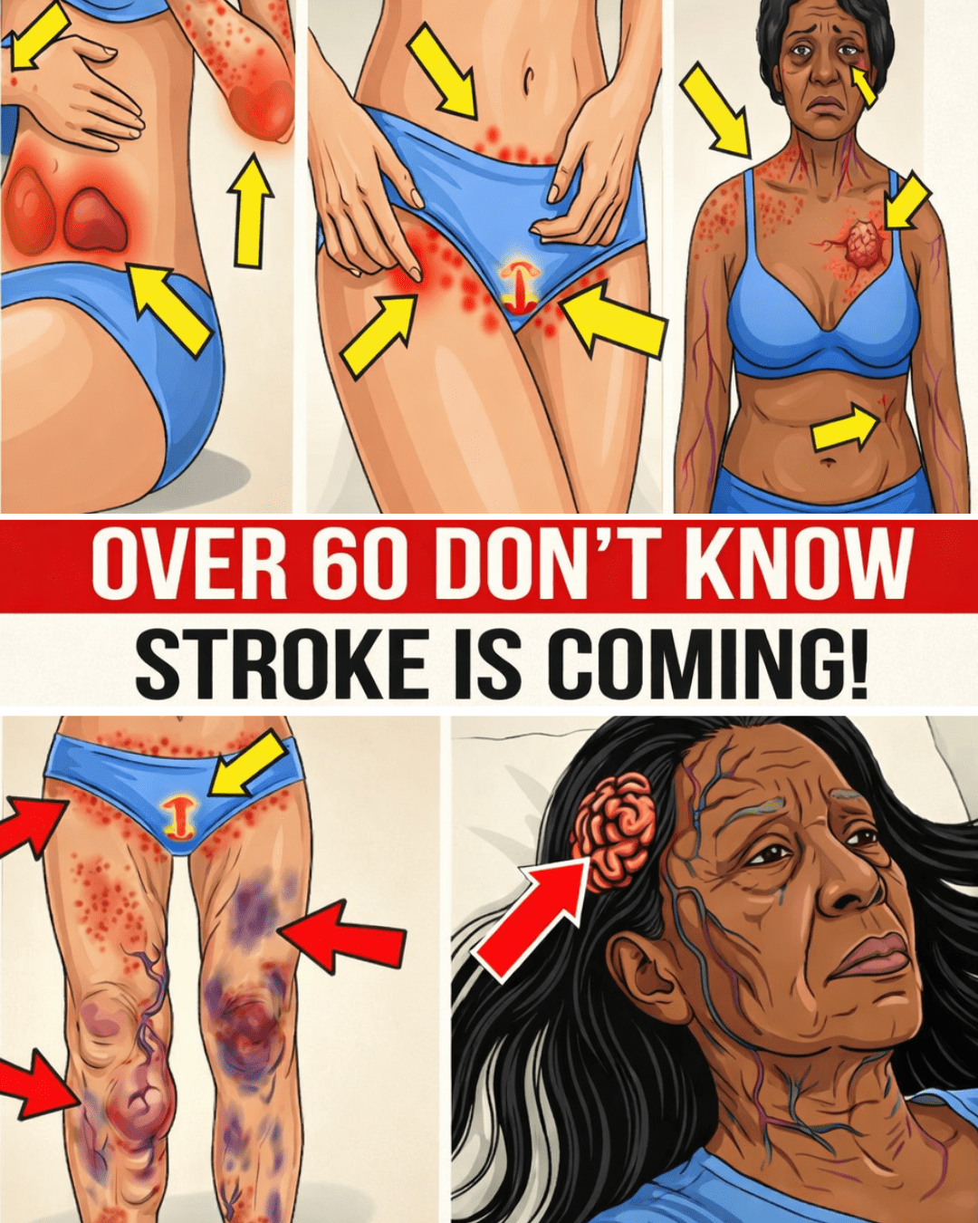 Women Over 60: 10 Leg Signs That Could Signal a Potential Stroke Risk – What to Watch For