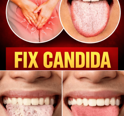 Are You Experiencing Symptoms of Candida Overgrowth? Discover 5 Natural Remedies That May Help Support Gut Balance