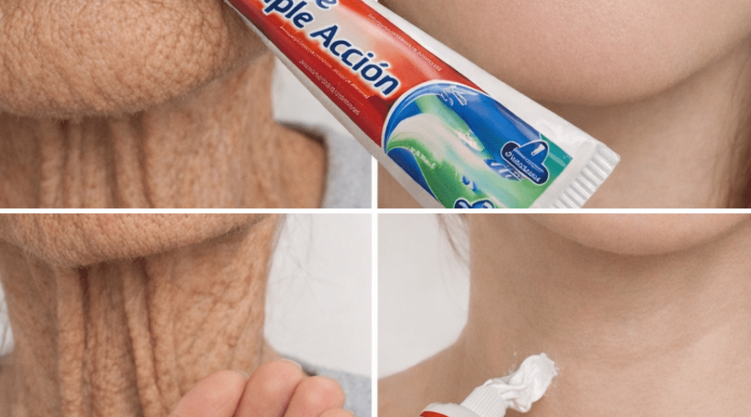 “It Looks Like I Had Cosmetic Surgery”: The Simple Homemade Remedy Many People Use to Improve Wrinkles and Dark Spots on Hands and Arms “It Looks Like I Had Cosmetic Surgery”: The Simple Homemade Remedy Many People Use to Improve Wrinkles and Dark Spots on Hands and Arms