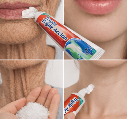 “It Looks Like I Had Cosmetic Surgery”: The Simple Homemade Remedy Many People Use to Improve Wrinkles and Dark Spots on Hands and Arms