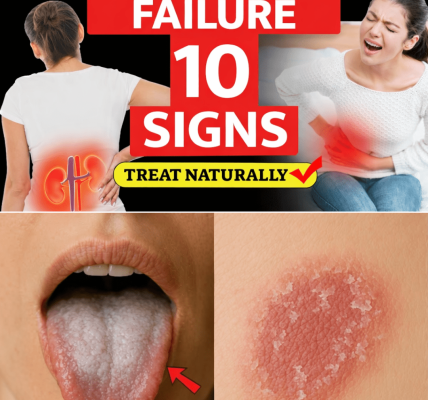 13 Early Warning Signs of Kidney Problems You Might Be Ignoring Every Day